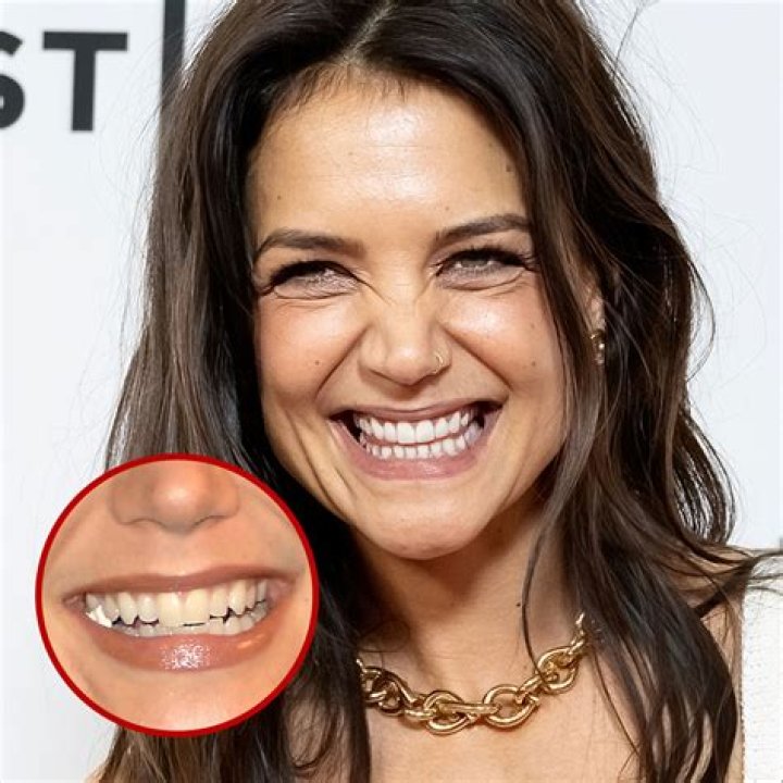 Celebrities That Wear Dentures: A Closer Look at Their Smiles