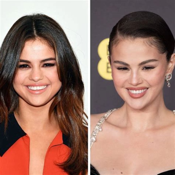 Selena Gomez Before and After: A Journey Through Transformation